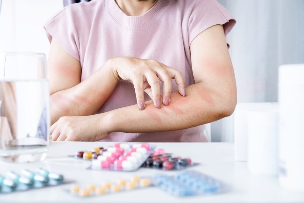 Modern Antihistamines for Allergy and Itching - USA Apteka