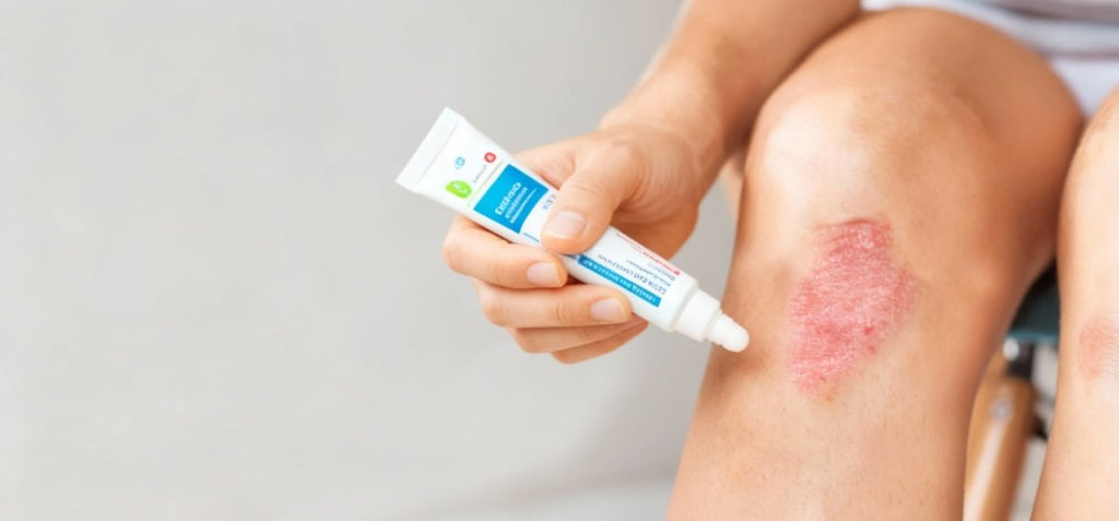 Hormonal and Non-Hormonal Bams for Skin and Sensitivity Conditions - USA Apteka